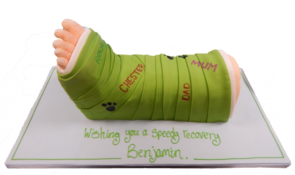 Image result for green leg cast  Leg cast, Walking cast, It cast